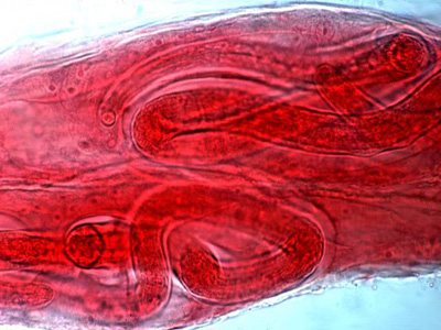 Trichinella spiralis cysts in striated muscle nurse cells.